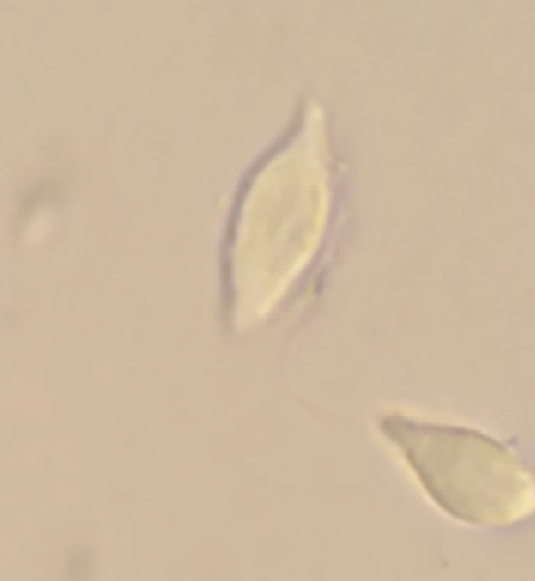Tritrichomonas foetus