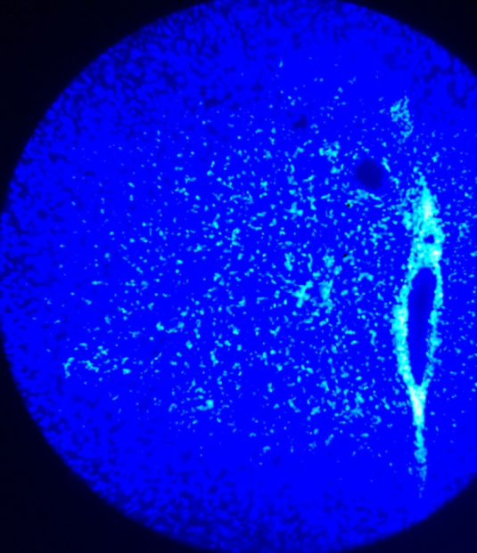 Blue Toxoplasma gondii seen under a confocal microscope